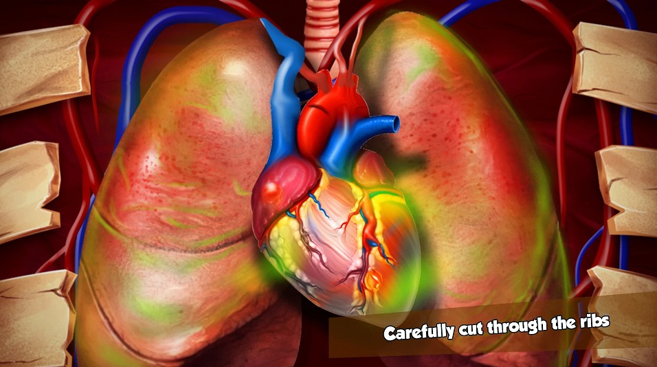 模拟心脏手术中文版